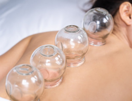 What are the Benefits of Cupping?