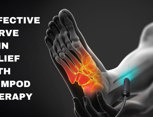 Effective Nerve Pain Relief with Stimpod Therapy